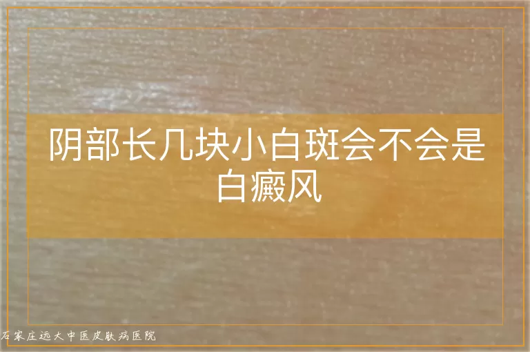 阴部长几块小白斑会不会是白癜风
