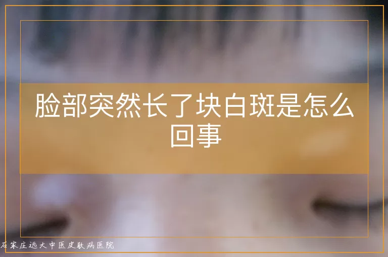 脸部突然长了块白斑是怎么回事
