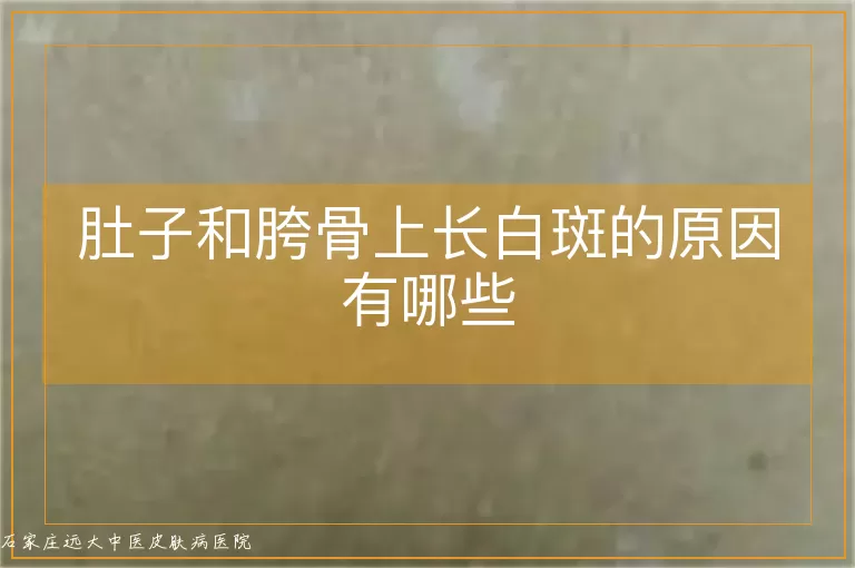 肚子和胯骨上长白斑的原因有哪些
