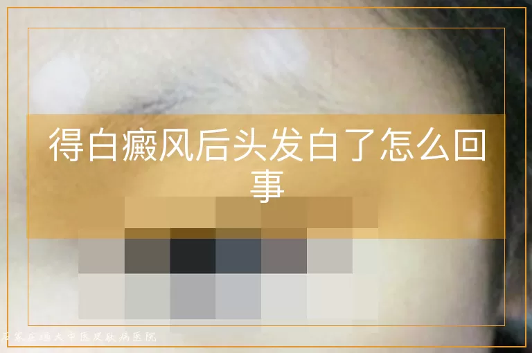 得白癜风后头发白了怎么回事