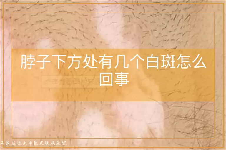 脖子下方处有几个白斑怎么回事