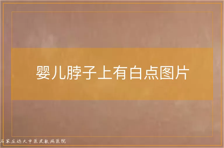 婴儿脖子上有白点图片
