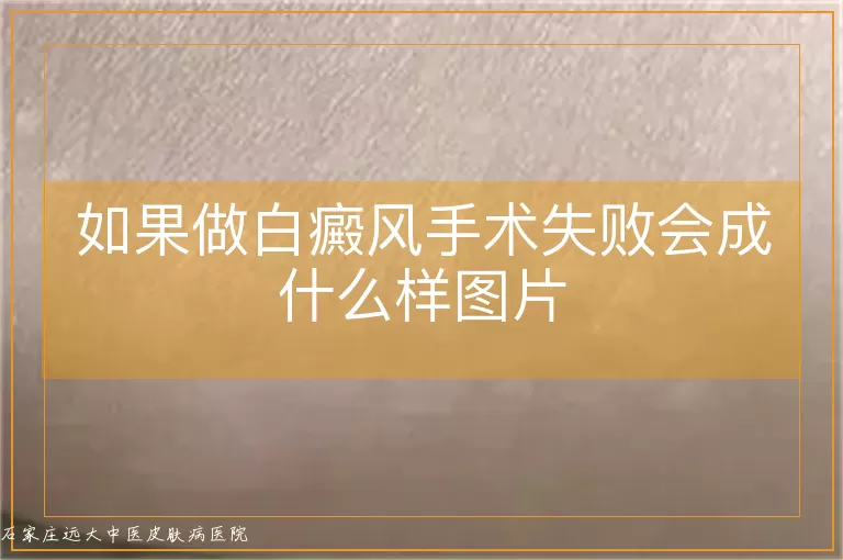 如果做白癜风手术失败会成什么样图片