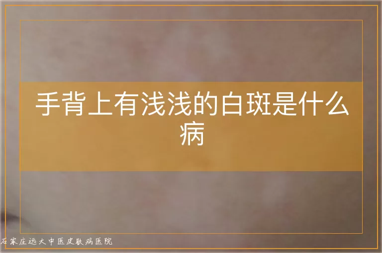 手背上有浅浅的白斑是什么病