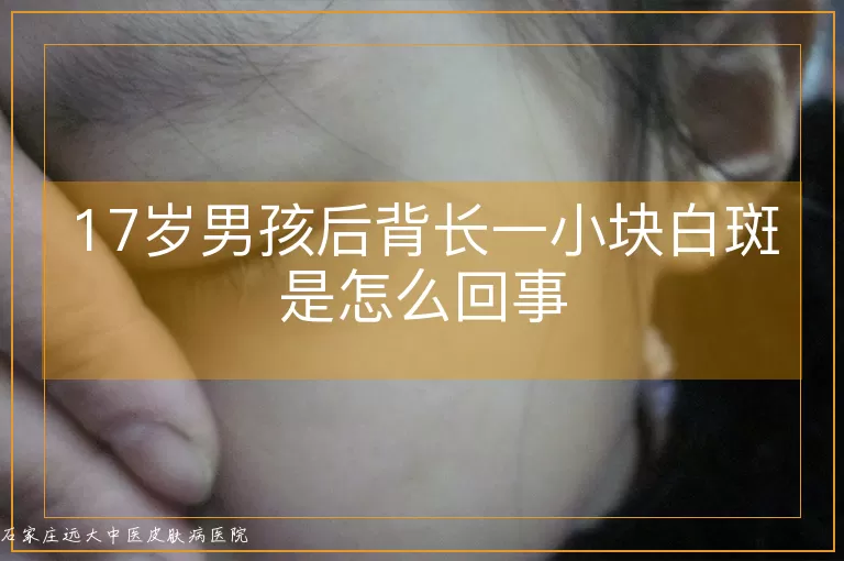 17岁男孩后背长一小块白斑是怎么回事