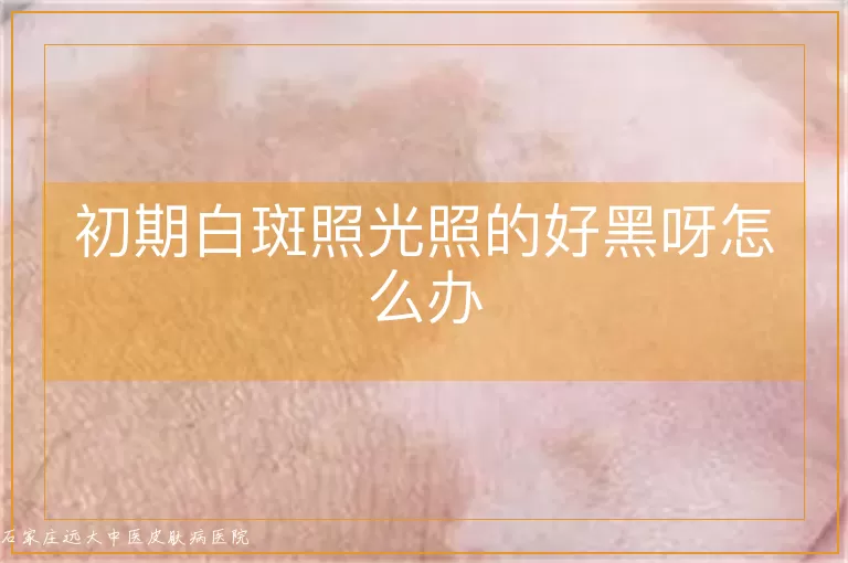 初期白斑照光照的好黑呀怎么办
