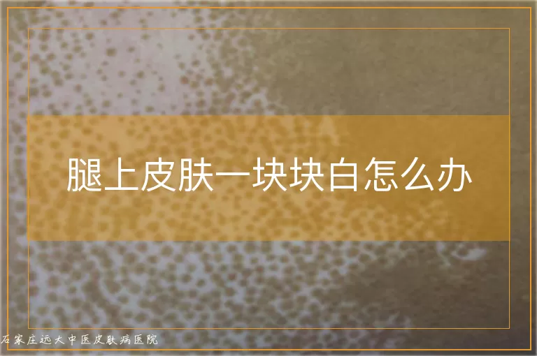 腿上皮肤一块块白怎么办