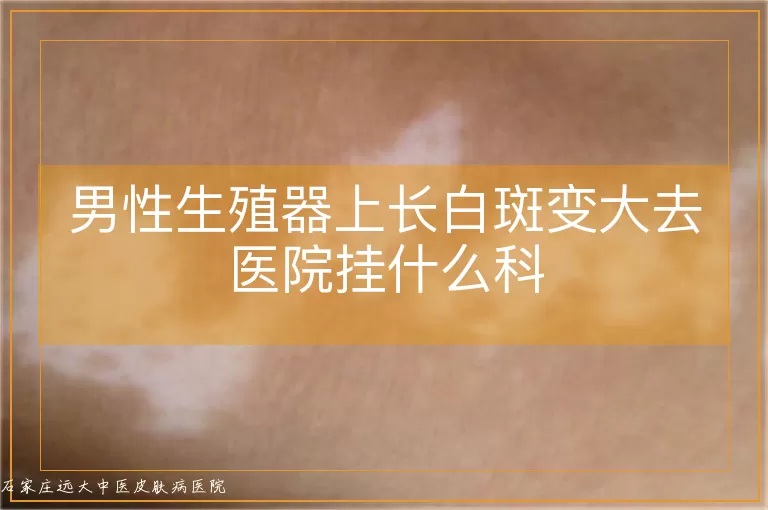 男性生殖器上长白斑变大去医院挂什么科
