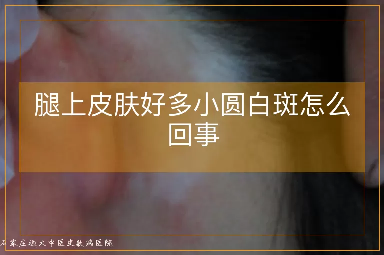 腿上皮肤好多小圆白斑怎么回事