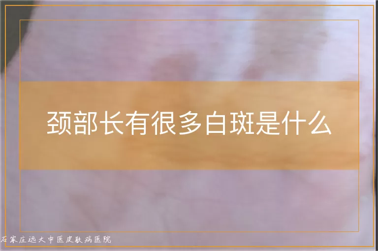 颈部长有很多白斑是什么