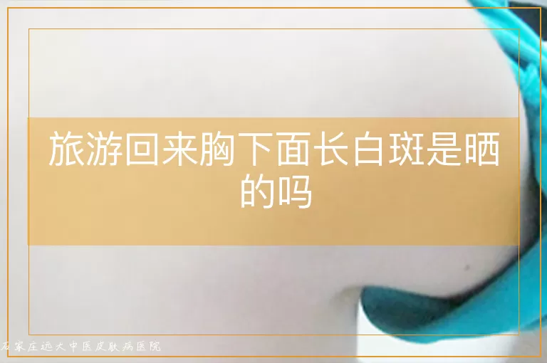 旅游回来胸下面长白斑是晒的吗