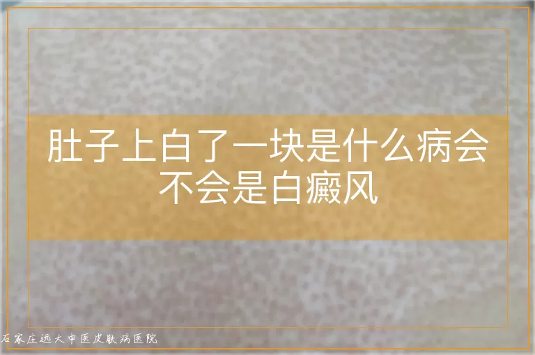肚子上白了一块是什么病会不会是白癜风