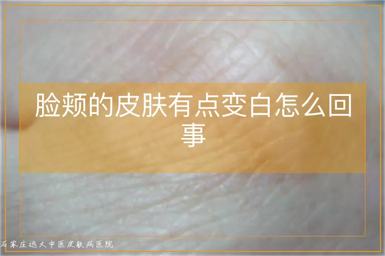 脸颊的皮肤有点变白怎么回事