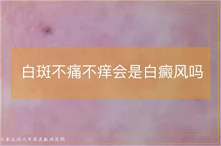 白斑不痛不痒会是白癜风吗
