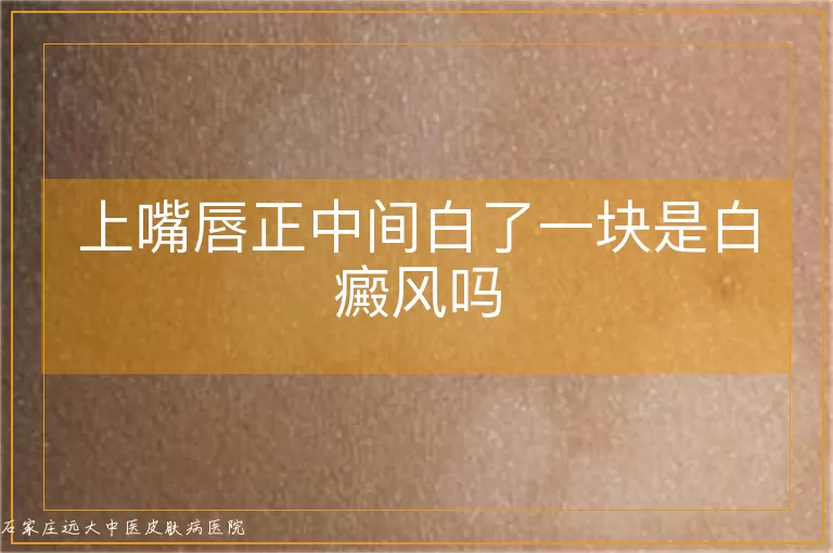 上嘴唇正中间白了一块是白癜风吗