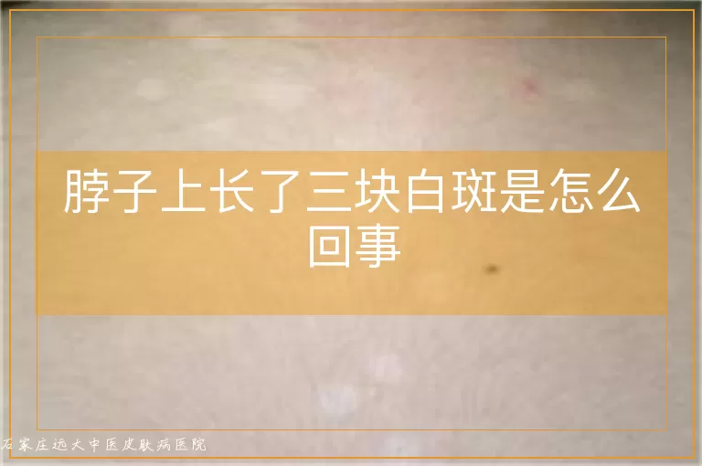 脖子上长了三块白斑是怎么回事