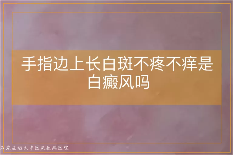 手指边上长白斑不疼不痒是白癜风吗