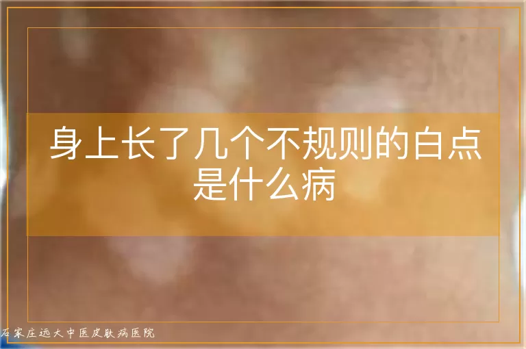 身上长了几个不规则的白点是什么病