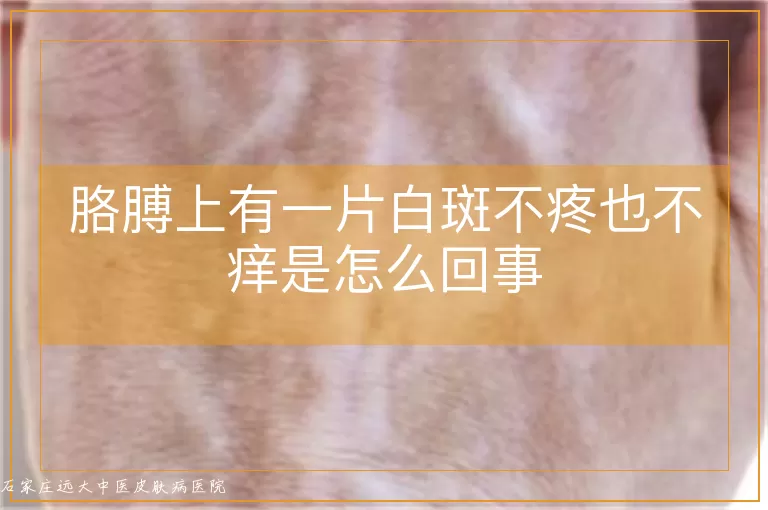 胳膊上有一片白斑不疼也不痒是怎么回事