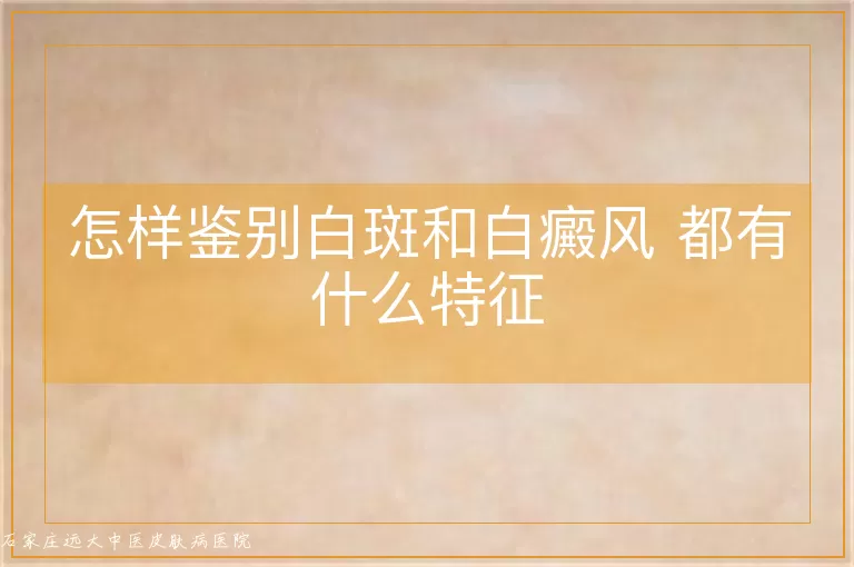 怎样鉴别白斑和白癜风 都有什么特征