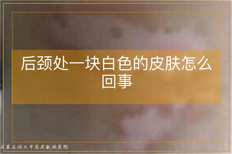 后颈处一块白色的皮肤怎么回事