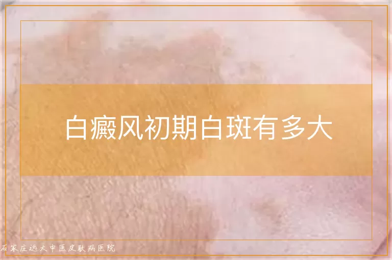 白癜风初期白斑有多大