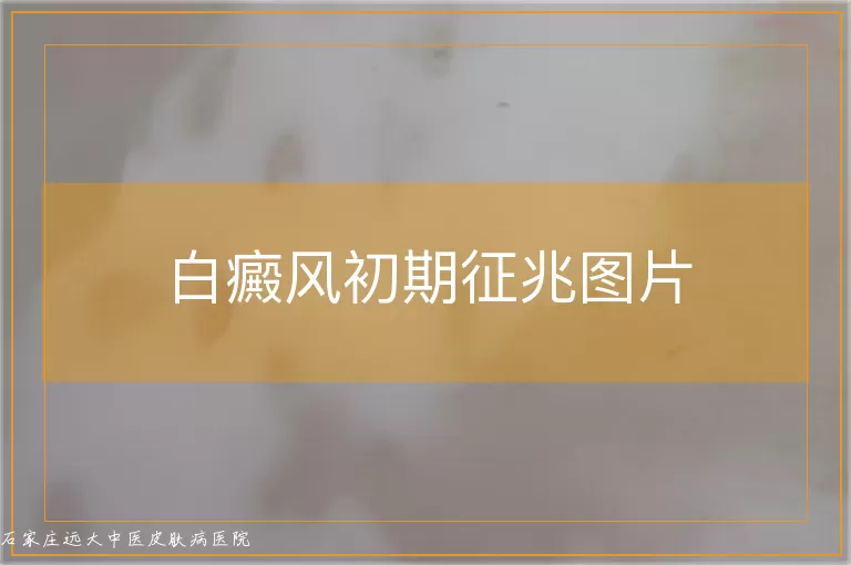 白癜风初期征兆图片