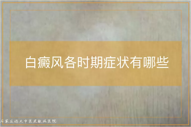 白癜风各时期症状有哪些