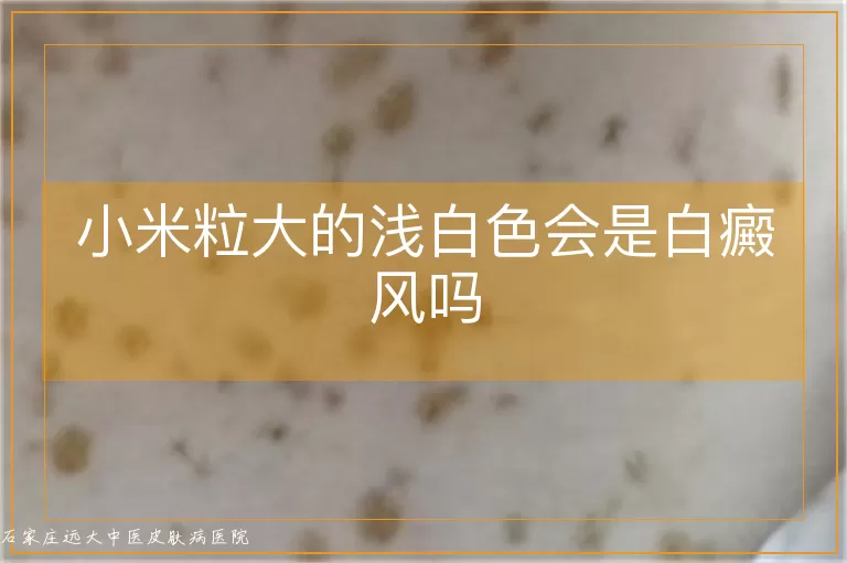 小米粒大的浅白色会是白癜风吗