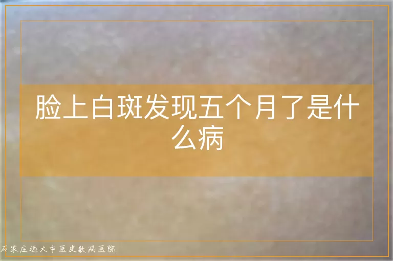 脸上白斑发现五个月了是什么病