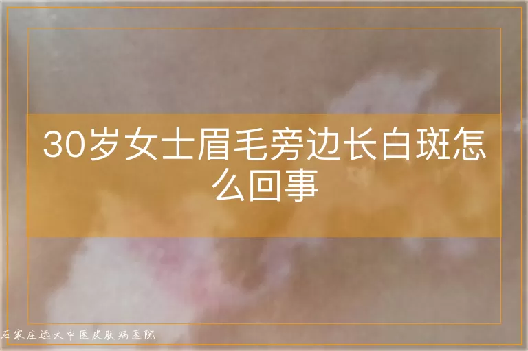 30岁女士眉毛旁边长白斑怎么回事