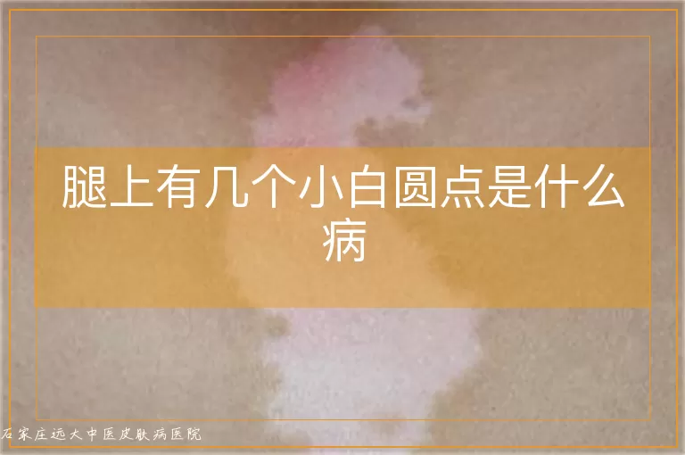 腿上有几个小白圆点是什么病