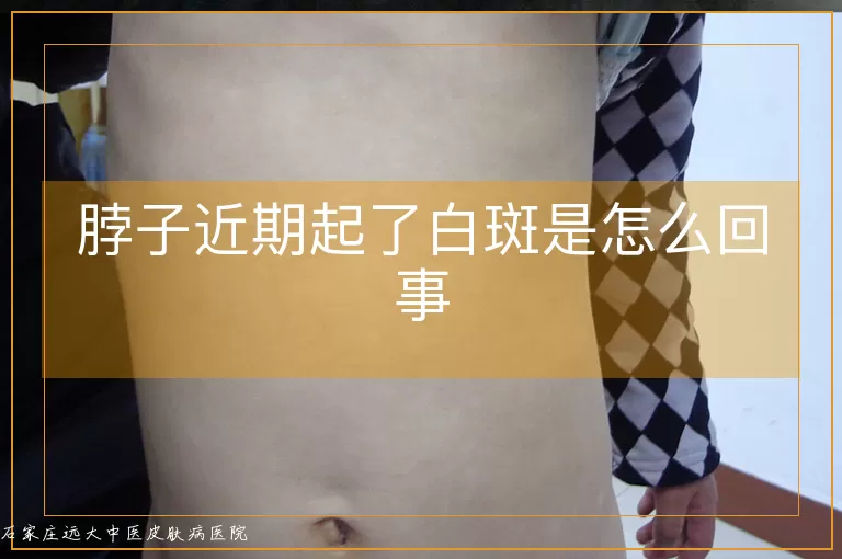 脖子近期起了白斑是怎么回事