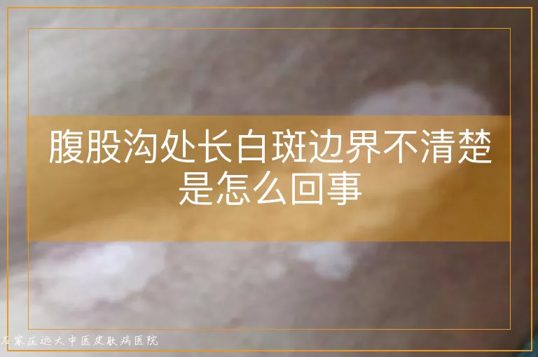 腹股沟处长白斑边界不清楚是怎么回事