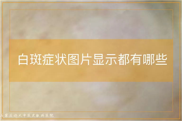 白斑症状图片显示都有哪些