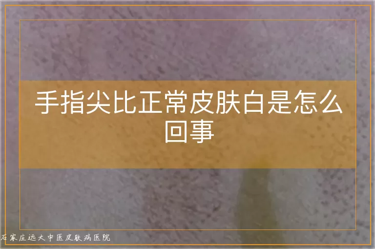 手指尖比正常皮肤白是怎么回事