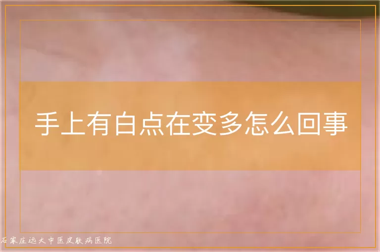 手上有白点在变多怎么回事