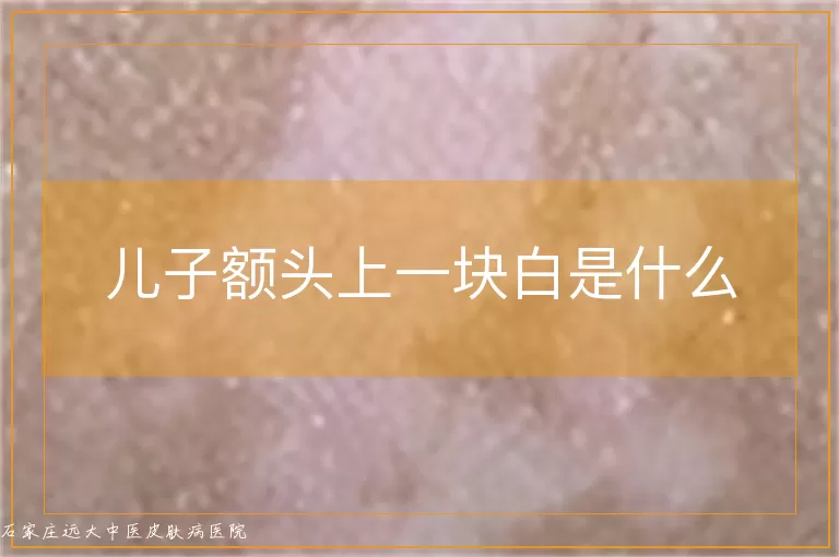 儿子额头上一块白是什么