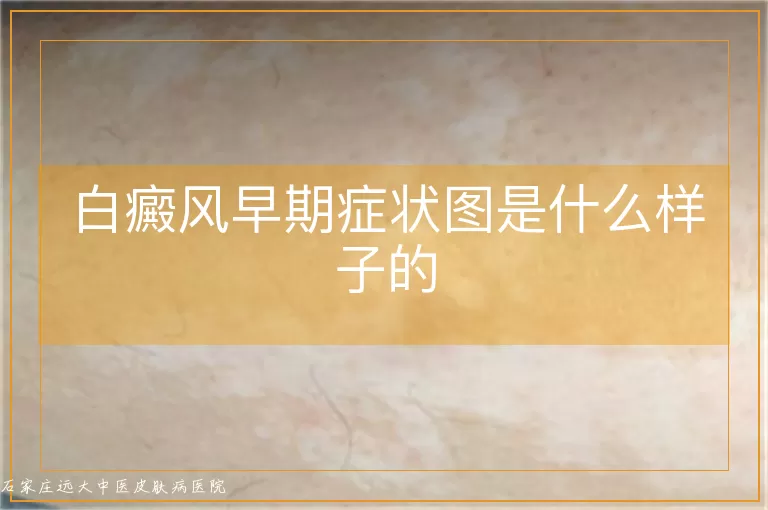 白癜风早期症状图是什么样子的
