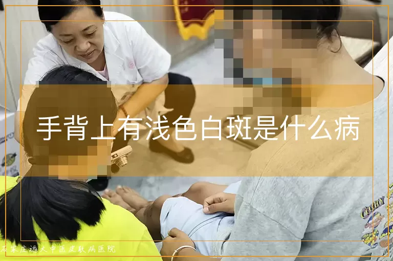 手背上有浅色白斑是什么病