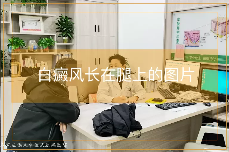 白癜风长在腿上的图片