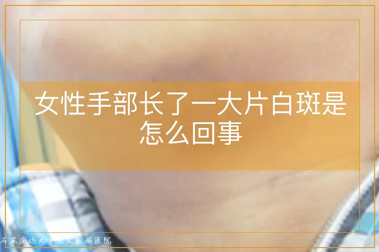 女性手部长了一大片白斑是怎么回事
