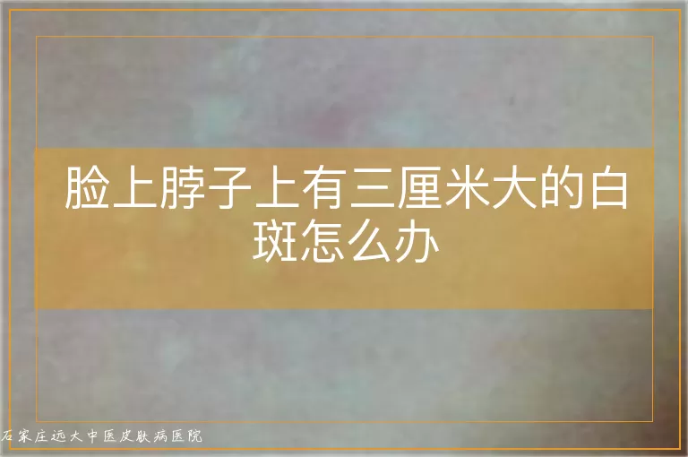 脸上脖子上有三厘米大的白斑怎么办