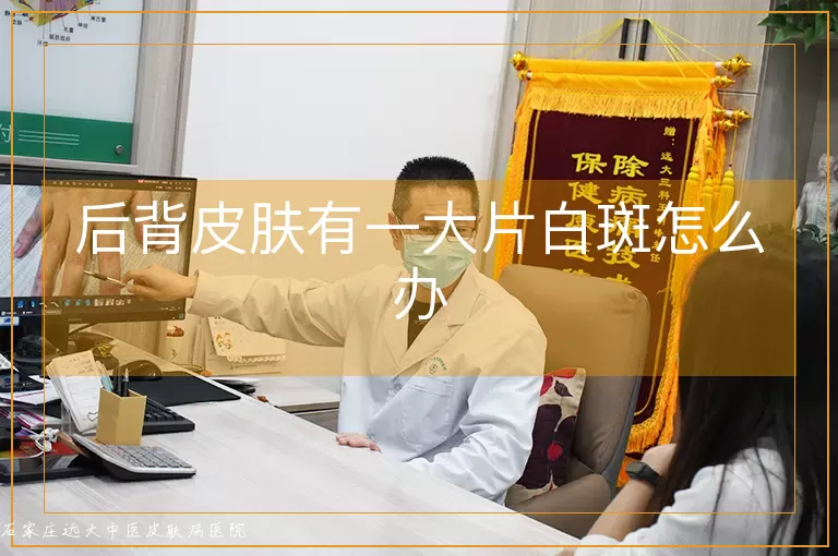 后背皮肤有一大片白斑怎么办
