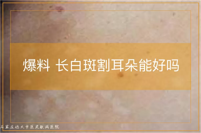 爆料 长白斑割耳朵能好吗