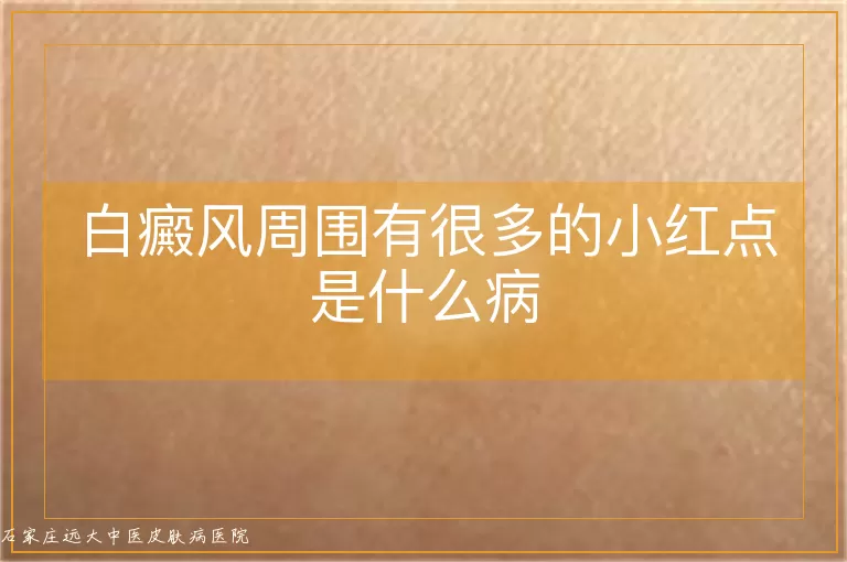 白癜风周围有很多的小红点是什么病