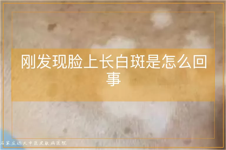 刚发现脸上长白斑是怎么回事