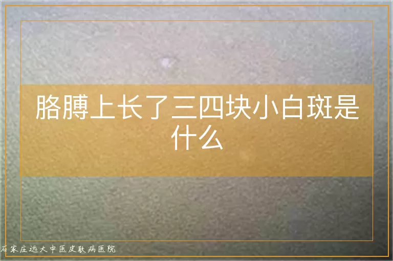 胳膊上长了三四块小白斑是什么