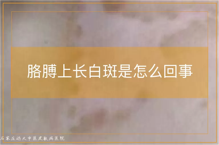 胳膊上长白斑是怎么回事