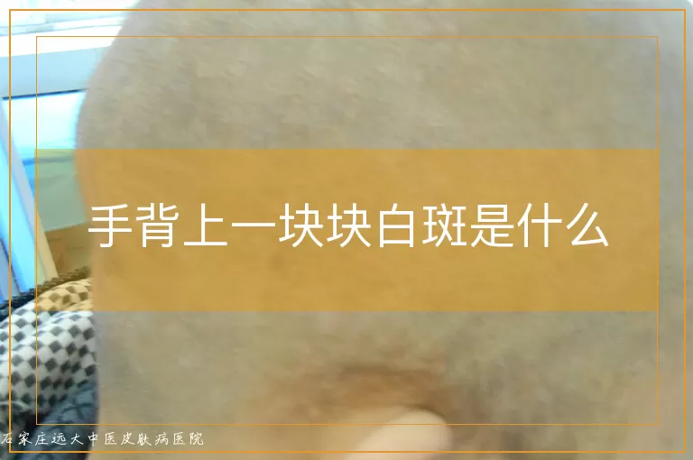 手背上一块块白斑是什么